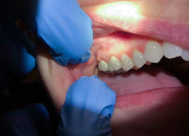 Best Emergency Orthodontic Repairs in East Sandwich, MA